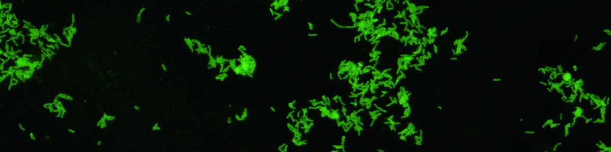 La bactérie Xylella fastidiosa - État des lieux et des connaissances 