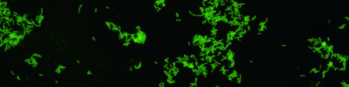 La bactérie Xylella fastidiosa - État des lieux et des connaissances La bactérie Xylella fastidiosa - État des lieux et des connaissances