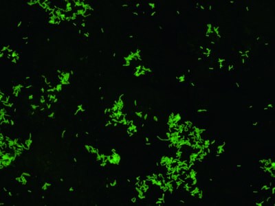 La bactérie Xylella fastidiosa - État des lieux et des connaissances 