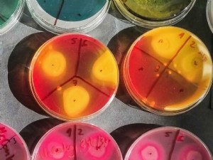 SPIN-FERT : révolutionner la gestion des sols et substituer la tourbe pour une agriculture durable 